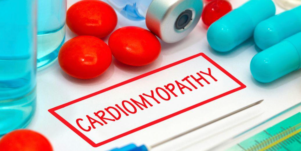 principales opciones de tratamiento para la miocardiopatía - modern heart and vascular