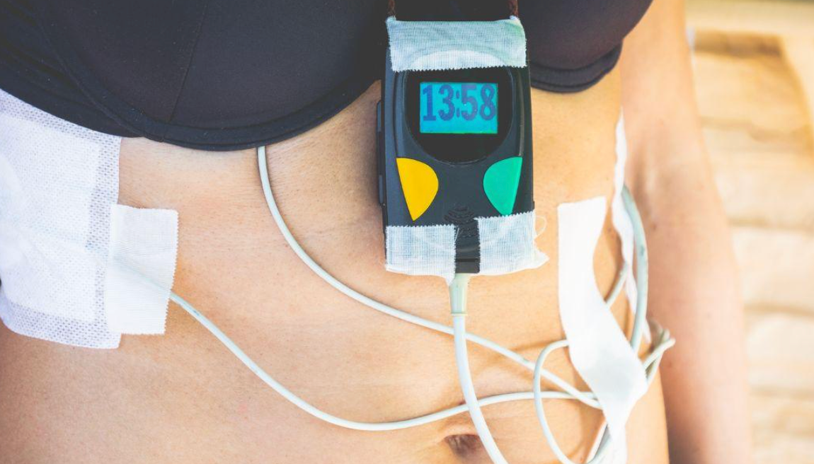 what is a holter monitor - modern heart and vascular
