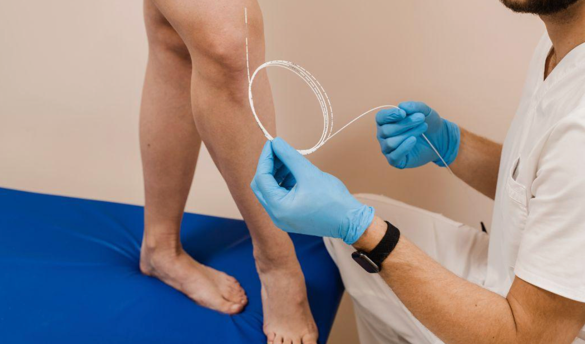 qué es una prueba de insuficiencia venosa - modern heart and vascular en houston, tx